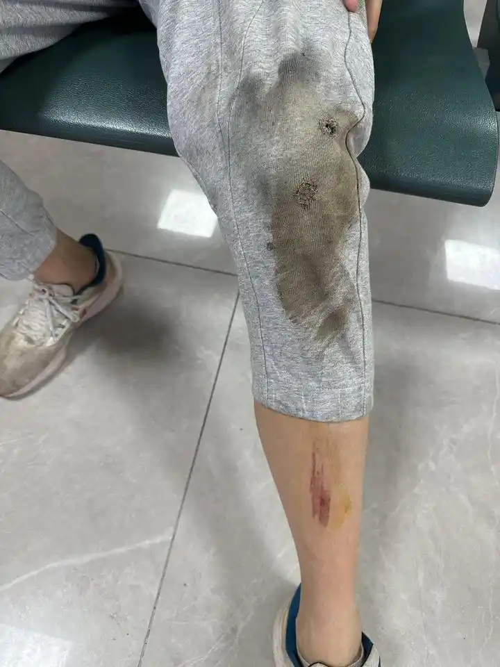 义乌一游乐园滑板车刹车失灵致两名儿童受伤？相关部门：加大安全排查力度