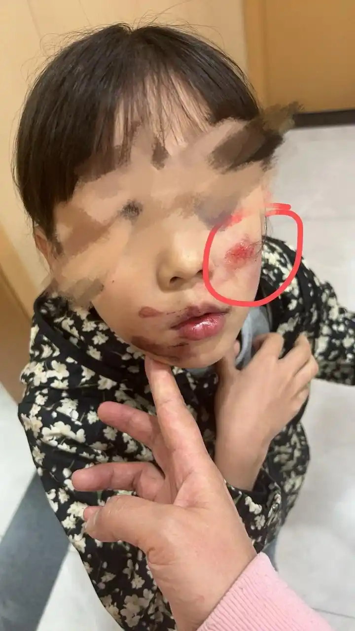 义乌一游乐园滑板车刹车失灵致两名儿童受伤？相关部门：加大安全排查力度